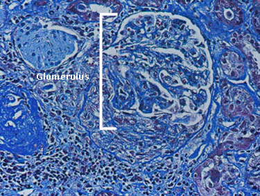 Glomerulus